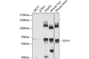 Western blot analysis of extracts of various cell lines, using SGSH antibody (ABIN6129760, ABIN6147711, ABIN6147712 and ABIN6224170) at 1:1000 dilution. (SGSH anticorps  (AA 273-502))