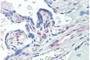 Human Placenta (formalin-fixed, paraffin-embedded) stained with PDGFRB antibody ABIN462353 followed by biotinylated anti-mouse IgG secondary antibody ABIN481714, alkaline phosphatase-streptavidin and chromogen. (PDGFRB anticorps)