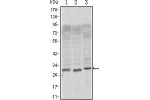 Western blot analysis using CD69 mouse mAb against, Jurkat (1), L1210 (2) and TPH-1 (3) cell lysate.