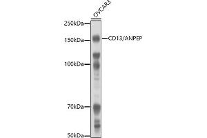 Western blot analysis of extracts of OVC cells, using CD13/ANPEP antibody (ABIN6131185, ABIN6136911, ABIN6136912 and ABIN6221309) at 1:1000 dilution. (CD13 anticorps  (AA 668-967))