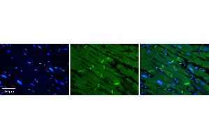 Rabbit Anti-SLC40A1 Antibody   Formalin Fixed Paraffin Embedded Tissue: Human heart Tissue Observed Staining: Plasma membrane in intercalated disk Primary Antibody Concentration: 1:100 Other Working Concentrations: N/A Secondary Antibody: Donkey anti-Rabbit-Cy3 Secondary Antibody Concentration: 1:200 Magnification: 20X Exposure Time: 0.