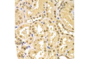 Immunohistochemistry of paraffin-embedded human kidney using SFN Antibody. (14-3-3 sigma/SFN anticorps  (AA 1-248))