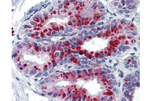 Immunohistochemistry (IHC) image for anti-Potassium Channel, Subfamily K, Member 9 (KCNK9) (N-Term) antibody (ABIN2776216) (KCNK9 anticorps  (N-Term))