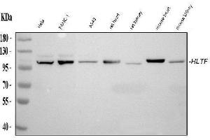 Western blot analysis of HLTF using anti-HLTF antibody (ABIN4886619). (HLTF anticorps  (AA 911-1009))