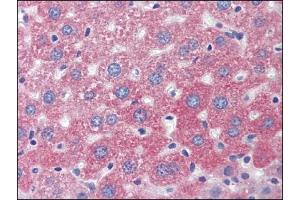 Image no. 1 for anti-Lysosomal-Associated Membrane Protein 1 (LAMP1) (Center) antibody (ABIN303277) (LAMP1 anticorps  (Center))