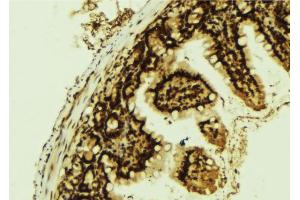 ABIN6267260 at 1/100 staining Mouse colon tissue by IHC-P. (EGFR anticorps  (pTyr1016))