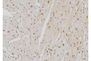 ABIN6277599 at 1/100 staining Mouse heart tissue by IHC-P. (Lamin B Receptor anticorps  (Internal Region))