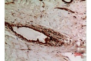 Immunohistochemistry (IHC) analysis of paraffin-embedded Human Breast, antibody was diluted at 1:100.