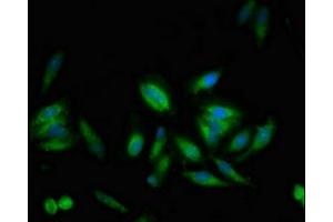 Immunofluorescent analysis of Hela cells using ABIN7174250 at dilution of 1:100 and Alexa Fluor 488-congugated AffiniPure Goat Anti-Rabbit IgG(H+L) (USP1 anticorps  (AA 453-592))