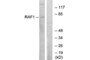 Western Blotting (WB) image for anti-V-Raf-1 Murine Leukemia Viral Oncogene Homolog 1 (RAF1) (AA 311-360) antibody (ABIN2888699) (RAF1 anticorps  (AA 311-360))