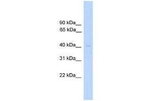 WB Suggested Anti-DUSP5 Antibody Titration: 0. (DUSP5 anticorps  (Middle Region))