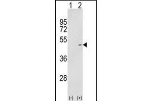 Western blot analysis of P2K2 (arrow) using rabbit polyclonal P2K2- (ABIN1881526 and ABIN2842063).