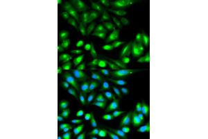 Immunofluorescence analysis of HeLa cells using RHOC antibody. (RHOC anticorps)