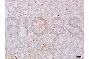 Formalin-fixed and paraffin embedded human brain tissue labeled with Anti-GPIIb Polyclonal Antibody, Unconjugated (ABIN748358) at 1:200 followed by conjugation to the secondary antibody, (SP-0023), and DAB staining (Integrin Alpha2b anticorps  (AA 351-450))