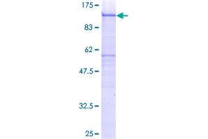 Image no. 1 for Syndecan 4 (SDC4) (AA 19-198) protein (GST tag) (ABIN1319343)