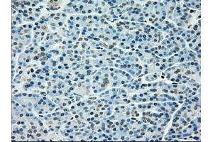 Immunohistochemical staining of paraffin-embedded pancreas tissue using anti-TYRO3mouse monoclonal antibody. (TYRO3 anticorps)