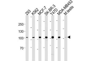 Western Blotting (WB) image for anti-Angiotensin I Converting Enzyme 2 (ACE2) antibody (ABIN3004589) (ACE2 anticorps)