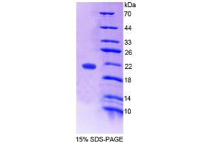 SDS-PAGE analysis of Human WTAP Protein. (WTAP Protéine)