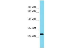 Host: Rabbit Target Name: C8orf46 Sample Type: Fetal Liver lysates Antibody Dilution: 1. (C8ORF46 anticorps  (C-Term))