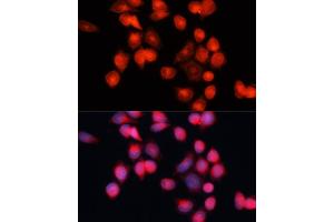 Immunofluorescence analysis of HeLa cells using SLC25 antibody (ABIN7270430) at dilution of 1:100 (40x lens). (SLC25A5 anticorps  (AA 150-250))