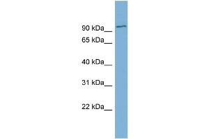 WB Suggested Anti-FBXO34  Antibody Titration: 0. (FBXO34 anticorps  (Middle Region))