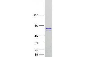 Validation with Western Blot