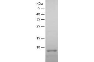 Western Blotting (WB) image for Apolipoprotein C-I (APOC1) (AA 27-83) protein (His-IF2DI Tag) (ABIN7121868)