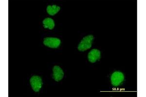 Immunofluorescence of monoclonal antibody to ATR on HeLa cell. (ATR anticorps  (AA 2545-2644))