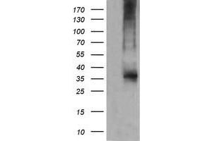 Western Blotting (WB) image for anti-T-cell surface glycoprotein CD1c (CD1C) antibody (ABIN2670659) (CD1c anticorps)