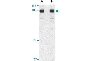 Western blot analysis of STIM2 in A-20 cell lysate with STIM2 polyclonal antibody  at (A) 0. (Stim2 anticorps  (C-Term))