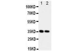 Anti-CD68 antibody, Western blotting Lane 1: Rat Spleen Tissue Lysate Lane 2: Rat Lung Tissue Lysate
