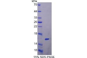 Image no. 1 for Follicle Stimulating Hormone, beta Polypeptide (FSHB) (AA 21-130) protein (His tag) (ABIN4989690)