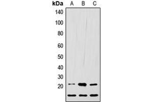 Western blot analysis of LIF expression in HEK293T (A), Raw264. (LIF anticorps  (C-Term))
