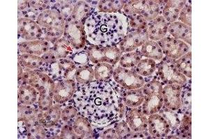 Expression of KCNK13 in rat kidney - Immunohistochemical staining in paraffin-embedded sections of rat kidney using Anti-KCNK13 (THIK-1) (extracellular) Antibody (ABIN7043444, ABIN7045019 and ABIN7045020), (1:50).