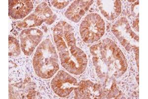 Image no. 1 for anti-Tripartite Motif Containing 25 (TRIM25) (AA 243-491) antibody (ABIN1501503)