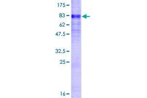 Image no. 1 for Solute Carrier Family 16, Member 1 (Monocarboxylic Acid Transporter 1) (SLC16A1) (AA 1-500) protein (GST tag) (ABIN7540254)