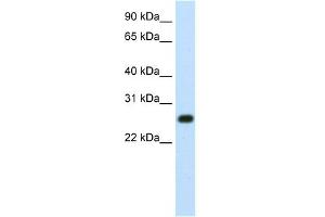 WB Suggested Anti-MINA Antibody Titration:  1. (MINA anticorps  (N-Term))