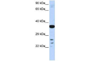 WB Suggested Anti-VSX1 Antibody Titration:  0. (VSX1 anticorps  (Middle Region))