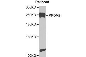 Western blot analysis of extracts of rat heart cells, using PRDM2 antibody. (PRDM2 anticorps)