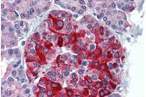 Human Pancreas: Formalin-Fixed, Paraffin-Embedded (FFPE) (RBP4 anticorps  (AA 19-202))