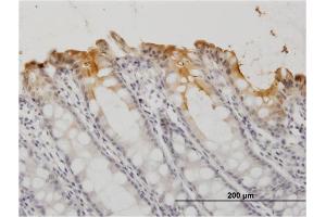 Immunoperoxidase of monoclonal antibody to CEACAM1 on formalin-fixed paraffin-embedded human colon.