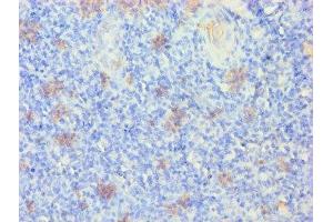 Immunohistochemistry of paraffin-embedded human tonsil tissue using ABIN7157384 at dilution of 1:100 (KRT14 anticorps  (AA 1-472))