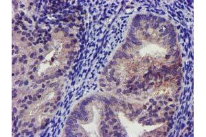 Immunohistochemistry (IHC) image for anti-Potassium Inwardly-Rectifying Channel, Subfamily J, Member 3 (KCNJ3) (AA 279-501) antibody (ABIN1491310)