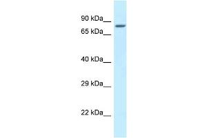 Host:  Rabbit  Target Name:  Zfp148  Sample Type:  Mouse Heart lysates  Antibody Dilution:  1.