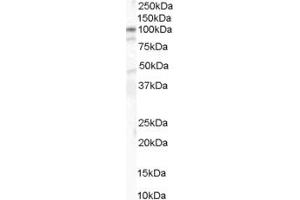 ABIN185626 (1µg/ml) staining of human colon lysate (35µg protein in RIPA buffer). (CTNNA1 anticorps  (Internal Region))