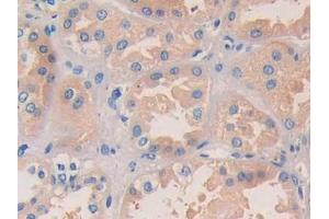 DAB staining on IHC-P; Samples: Human Kidney Tissue