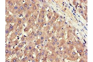 Immunohistochemistry of paraffin-embedded human liver tissue using ABIN7143426 at dilution of 1:100