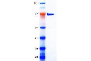 Validation with Western Blot
