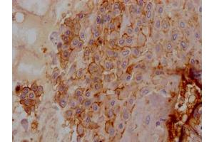 IHC image of ABIN7127406 diluted at 1:100 and staining in paraffin-embedded human placenta tissue performed on a Leica BondTM system. (Recombinant CD55 anticorps)