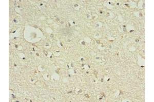 Immunohistochemistry of paraffin-embedded human brain tissue using ABIN7157583 at dilution of 1:100 (KIF12 anticorps  (AA 213-450))
